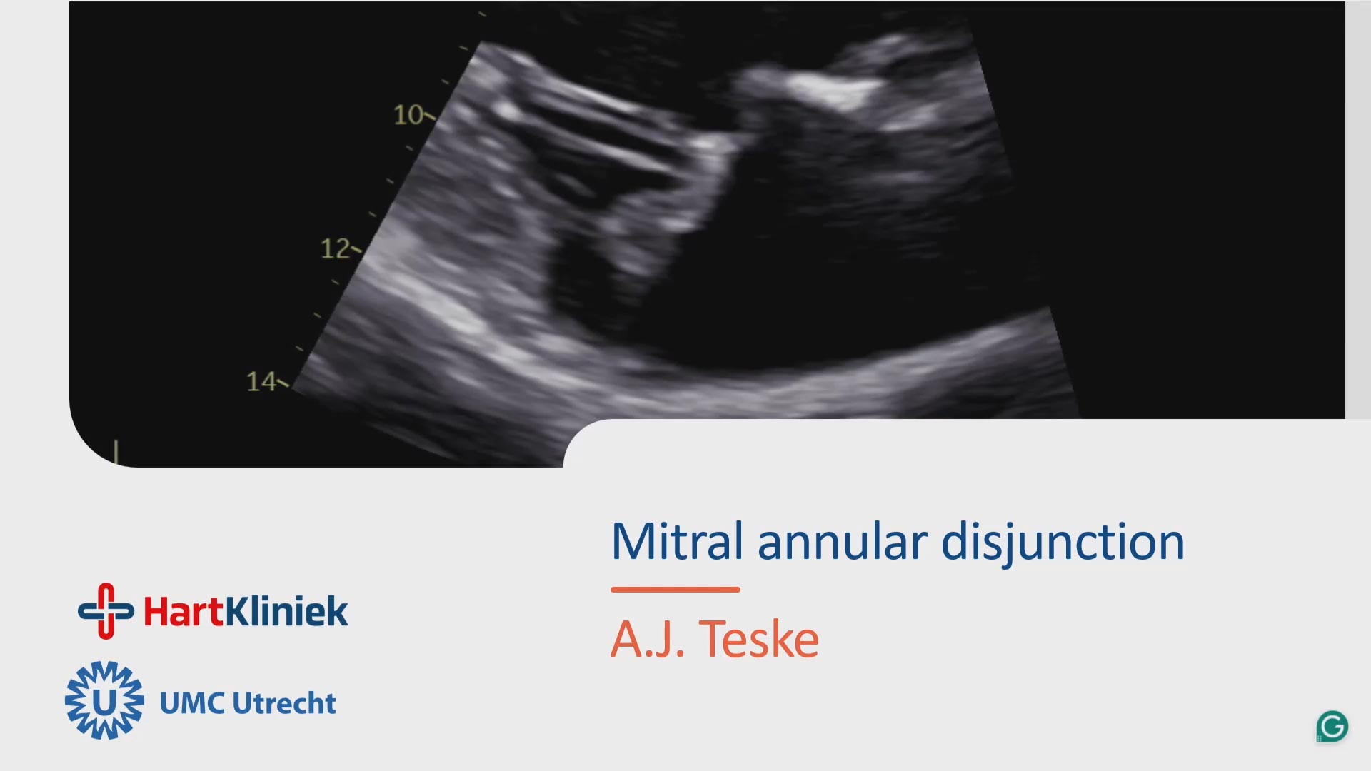 Teske0001