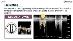Houthuizen0013